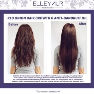 RED Onion Hair Growth & Anti-Dandruff Oil