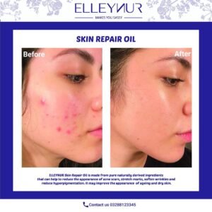 Skin Repair Oil